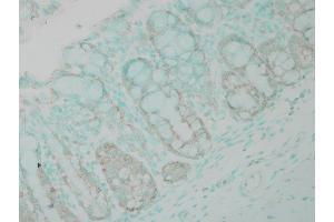 Immunohistochemistry (IHC) image for anti-Ubiquitin (Ub) antibody (ABIN361831)