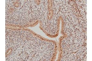 Immunohistochemistry (IHC) image for anti-LIM Domain Kinase 1 (LIMK1) (pThr508) antibody (ABIN6255701)