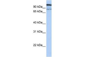 WB Suggested Anti-GAA Antibody Titration:  0. (GAA Antikörper  (N-Term))