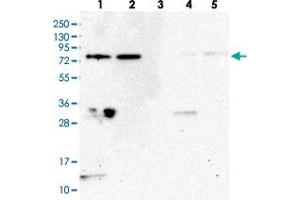 Western blot analysis of Lane 1: RT-4, Lane 2: U-251 MG, Lane 3: Human Plasma, Lane 4: Liver, Lane 5: Tonsil with WDR48 polyclonal antibody  at 1:250-1:500 dilution.