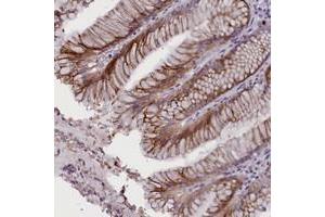 Immunohistochemical staining of human stomach with RTTN polyclonal antibody  shows moderate cytoplasmic positivity in glandular cells. (Rotatin (RTTN) Antikörper)