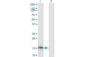 Western Blot analysis of RBP2 expression in transfected 293T cell line by RBP2 monoclonal antibody (M02), clone 3G12. (RBP2 Antikörper  (AA 45-134))