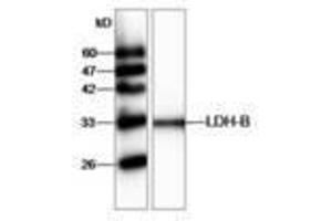 Image no. 1 for anti-Lactate Dehydrogenase B (LDHB) antibody (ABIN791438) (LDHB Antikörper)