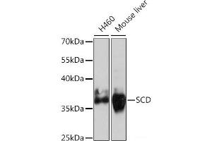 Western blot analysis of extracts of various cell lines using SCD Polyclonal Antibody at dilution of 1:1000. (SCD Antikörper)