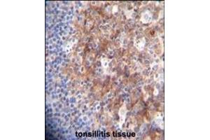 RCO Antibody (N-term) A immunohistochemistry analysis in forlin fixed and paraffin embedded hun tonsillitis tissue followed by peroxidase conjugation of the secondary antibody and DAB staining. (MARCO Antikörper  (AA 13-40))