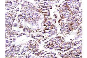 Immunohistochemistry (Paraffin-embedded Sections) (IHC (p)) image for anti-Mechanistic Target of Rapamycin (serine/threonine Kinase) (mTOR) (AA 2436-2492) antibody (ABIN676403)