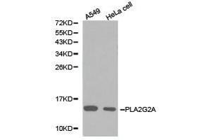 Western Blotting (WB) image for anti-Phospholipase A2, Group IIA (Platelets, Synovial Fluid) (PLA2G2A) antibody (ABIN1874153) (PLA2G2A Antikörper)
