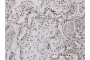 Immunostaining (ISt) image for anti-Replication Protein A4, 30kDa (RPA4) (AA 1-261) antibody (ABIN526172)