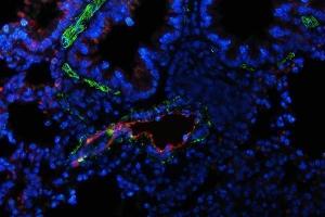 IF analysis of VWF and alpha-Smooth Muscle Actin using anti-VWF antibody (ABIN3042349) and anti-alpha-Smooth Muscle Actin antibody .