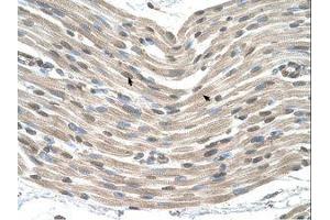 anti-Caudal Type Homeobox 4 (CDX4) (AA 181-230) antibody