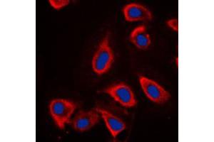Immunofluorescent analysis of mGLUR6 staining in NIH3T3 cells. (Metabotropic Glutamate Receptor 6 Antikörper  (C-Term))