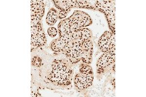 Immunohistochemistry (Paraffin-embedded Sections) (IHC (p)) image for anti-Mesenchyme Homeobox 2 (MEOX2) (AA 164-192) antibody (ABIN1537918)