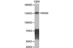 Western blot analysis of CEM cell lysate using NOS2 antibody. (NOS2 Antikörper)