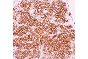 Immunohistochemistry (IHC) image for anti-Nuclear Factor of kappa Light Polypeptide Gene Enhancer in B-Cells 1 (NFKB1) (AA 1-360) antibody (ABIN3043587)