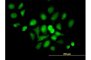 Immunofluorescence of purified MaxPab antibody to DDX20 on HeLa cell.