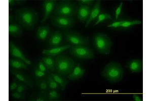 Immunofluorescence of monoclonal antibody to NR4A2 on HeLa cell.