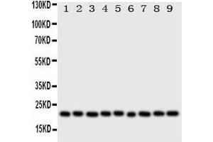 Western Blotting (WB) image for anti-Cytoglobin (CYGB) (AA 50-68), (N-Term) antibody (ABIN3043127)