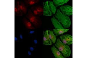 ABIN6257088 and ABIN6273791 staining  cells by IF/ICC. (CSNK2A2 Antikörper  (N-Term))
