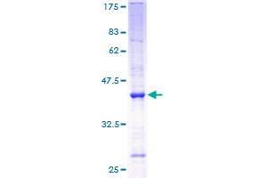 ANG Protein (AA 25-147) (GST tag)