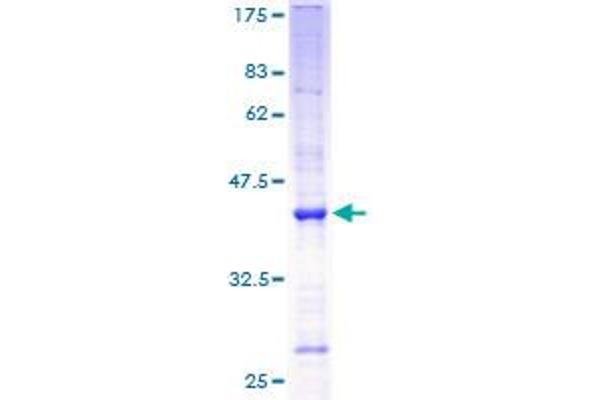 ANG Protein (AA 25-147) (GST tag)