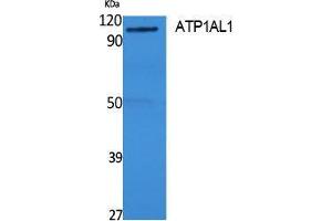 Western Blotting (WB) image for anti-ATPase, H+/K+ Transporting, Nongastric, alpha Polypeptide (ATP12A) (Internal Region) antibody (ABIN3178130) (ATP12A Antikörper  (Internal Region))