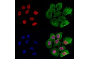 ABIN6261268 and ABIN6272941 staining Hela cells by IF/ICC. (DEK Antikörper  (Internal Region))