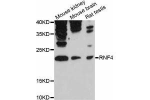 Western blot analysis of extracts of various cell lines, using RNF4 antibody (ABIN6291207) at 1:3000 dilution. (RNF4 Antikörper)