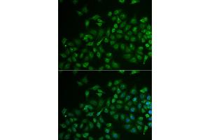 Immunofluorescence analysis of U2OS cells using MPP2 antibody (ABIN5974010). (MPP2 Antikörper)