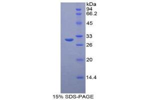 SDS-PAGE (SDS) image for Ornithine Carbamoyltransferase (OTC) (AA 107-350) protein (His tag) (ABIN1879605)