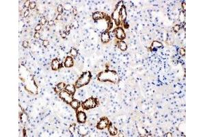 IHC-P: GLUT5 antibody testing of rat kidney tissue (SLC2A5 Antikörper  (Middle Region))