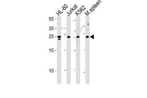 Western Blotting (WB) image for anti-Translin (TSN) antibody (ABIN2996697) (Translin Antikörper)