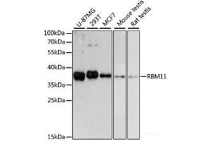 Western blot analysis of extracts of various cell lines using RBM11 Polyclonal Antibody at dilution of 1:3000. (RBM11 Antikörper)