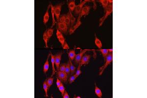 Immunofluorescence analysis of PC-12 cells using Vinculin antibody (ABIN6128911, ABIN6150070, ABIN6150071 and ABIN6218474) at dilution of 1:150. (Vinculin Antikörper  (AA 767-1066))