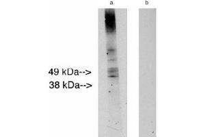 Image no. 1 for anti-Ceramide Synthase 2 (CERS2) antibody (ABIN265218) (Ceramide Synthase 2 Antikörper)