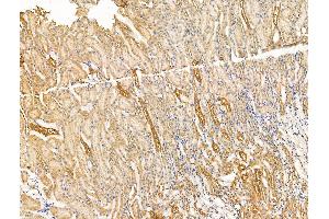 ABIN7094640 and ABIN7098690 at 1/100 staining Rat kidney tissue by IHC-P. (ITIH2 Antikörper  (C-Term))
