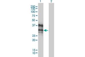 Western Blot analysis of DLX4 expression in transfected 293T cell line by DLX4 monoclonal antibody (M01), clone 1F11.