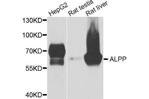 Western blot analysis of extracts of various cell lines, using ALPP antibody (ABIN5975263) at 1/1000 dilution. (PLAP Antikörper)