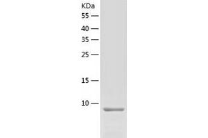 Western Blotting (WB) image for Chemokine (C-C Motif) Ligand 8 (CCL8) (AA 24-99) protein (His tag) (ABIN7122314)