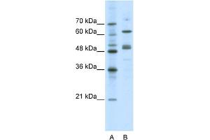 WB Suggested Anti-GATA4 Antibody Titration:  0. (GATA4 Antikörper  (N-Term))