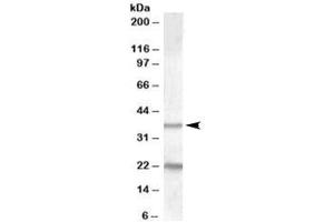 Western blot testing of human liver lysate with TUSC3 antibody at 1ug/ml. (TUSC3 Antikörper)