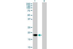 Western Blot analysis of SNX20 expression in transfected 293T cell line by SNX20 MaxPab polyclonal antibody. (SNX20 Antikörper  (AA 1-129))