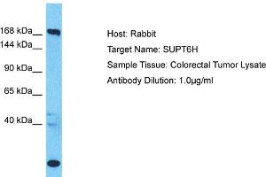 Host: Rabbit Target Name: SUPT6H Sample Type: Colorectal Tumor lysates Antibody Dilution: 1. (Spt6 Antikörper  (C-Term))