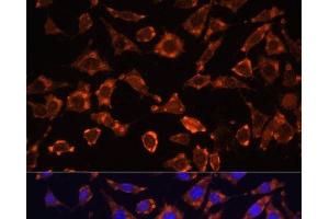 Immunofluorescence analysis of L929 cells using IL18 Polyclonal Antibody at dilution of 1:100. (IL-18 Antikörper)