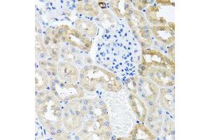 Immunohistochemistry of paraffin-embedded rat kidney using MYLK antibody at dilution of 1:100 (x40 lens). (MYLK Antikörper)