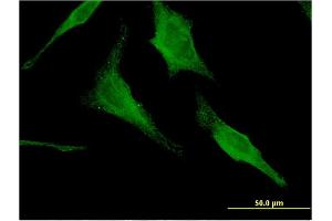 Immunofluorescence (IF) image for anti-Hexosaminidase A (HEXA) (AA 1-529) antibody (ABIN516401)