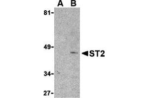 Western Blotting (WB) image for anti-Interleukin 1 Receptor-Like 1 (IL1RL1) (N-Term) antibody (ABIN1031587) (IL1RL1 Antikörper  (N-Term))