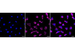 Immunocytochemical staining of Hela cells with HAPLN1 antibody (ABIN7799008), 1:1,000). (Rekombinanter HAPLN1 Antikörper)