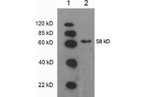 Western blot analysis: Lane 1: EasyWestern Protein Standard   Lane 2. (ATP6V1B2 Antikörper)