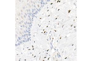 Immunohistochemistry (IHC) image for anti-Progesterone Receptor (PGR) antibody (ABIN7269533)