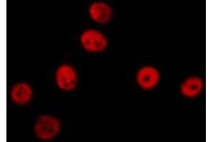 ABIN6277499 staining  NIH-3T3 cells by IF/ICC. (ERCC1 Antikörper  (Internal Region))